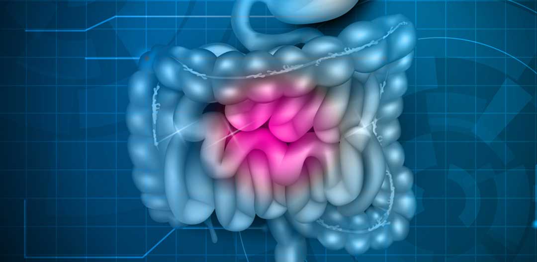Enterotomografia - Doutor Aprende