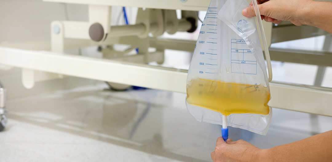 Debito urinario mortalidade - Doutor Aprende