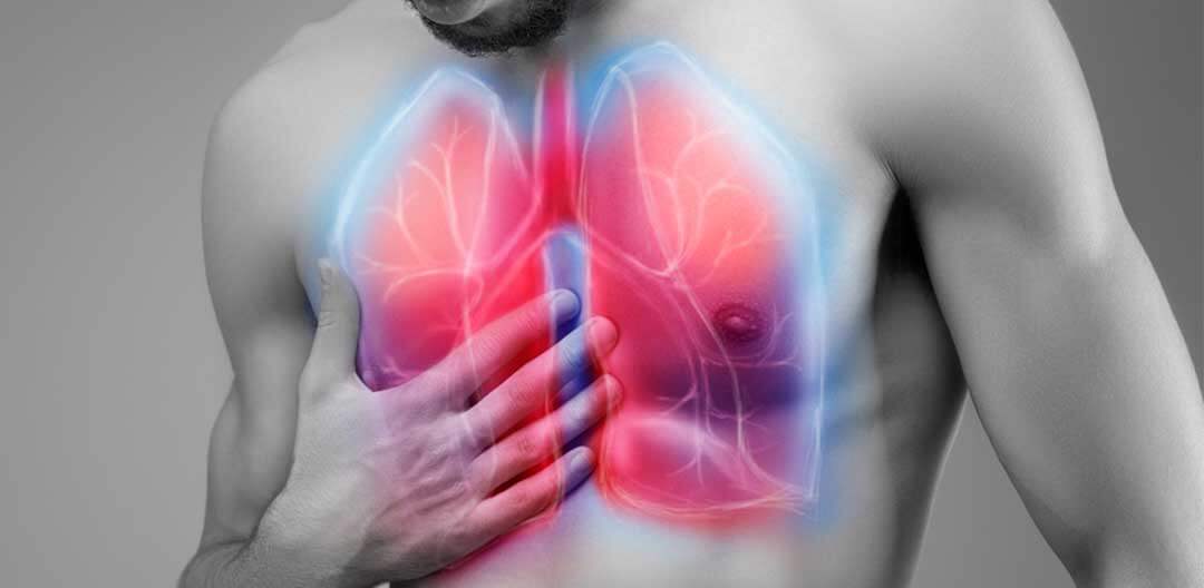 Diagnostico sarcoidose - Doutor Aprende