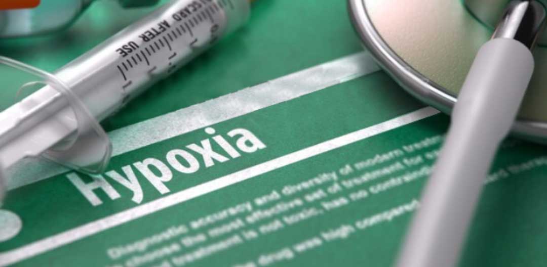 Resposta ventilatoria hipoxia - Doutor Aprende